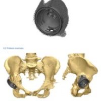 Obtencion-de-Imgenes-3D