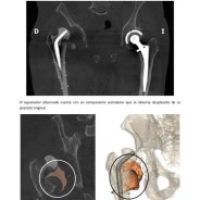 Planificacion-desde-la-Tomografia