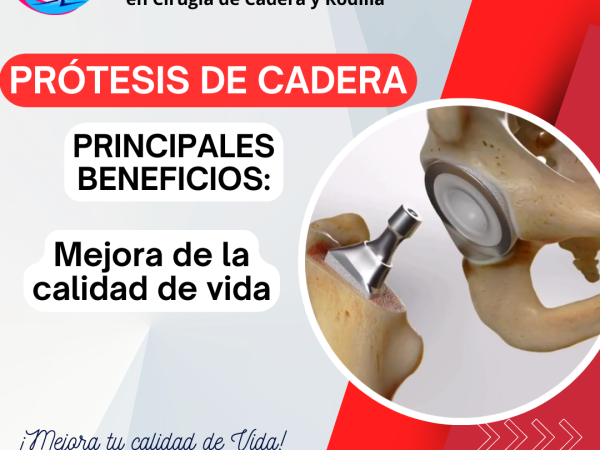 Protesis de Cadera Facebook Video